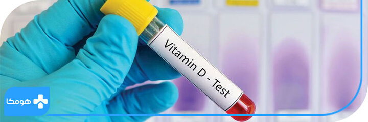 چگونه کمبود ویتامین دی تشخیص داده می‌شود؟